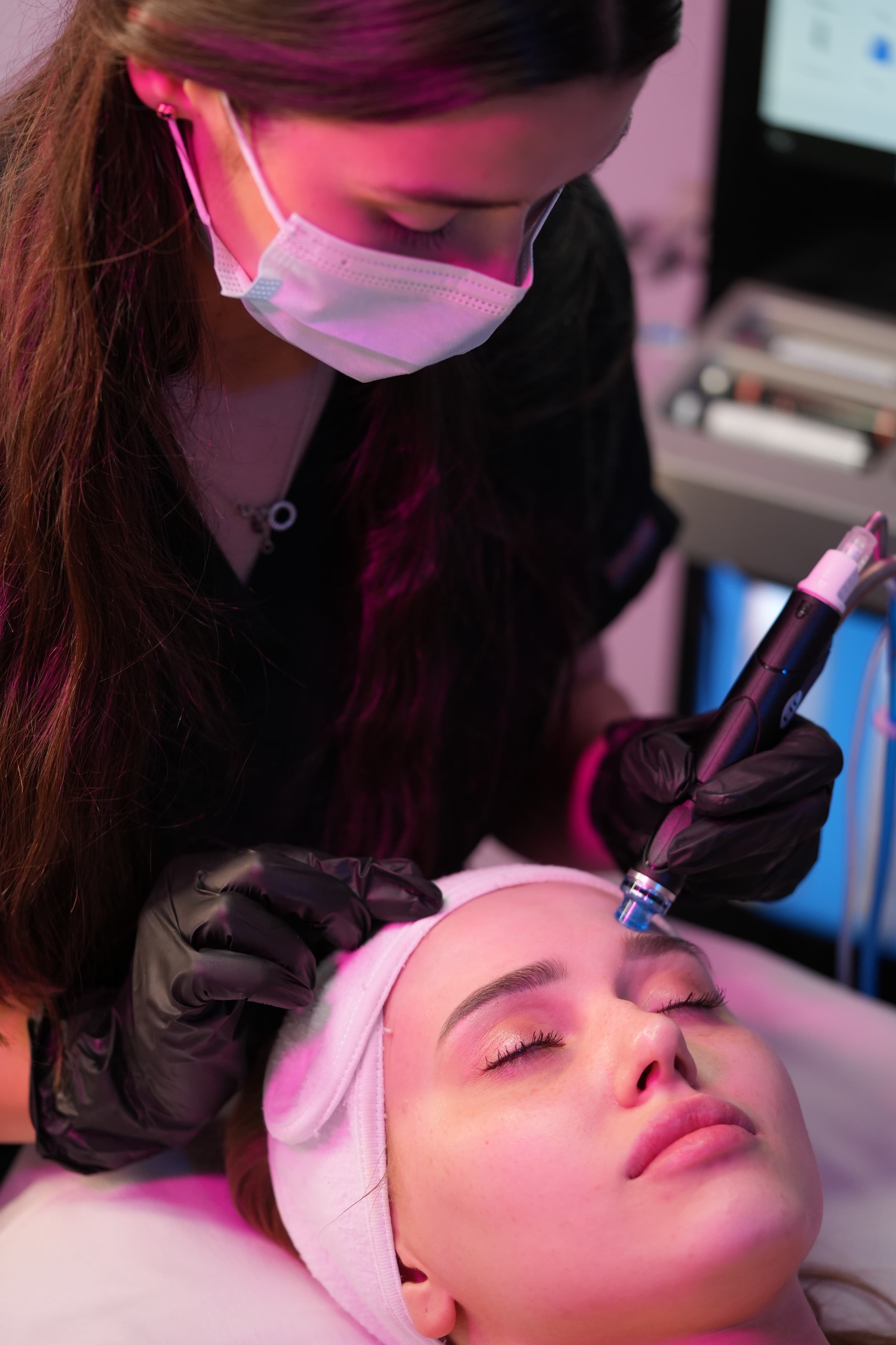 Micro Redlining + Chemical Peel